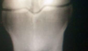 Horse Times Egypt: Equestrian Magazine :Articles :EQUINE MEDICINE -RADIOLOGY X-PERTS: A CASE STUDY

