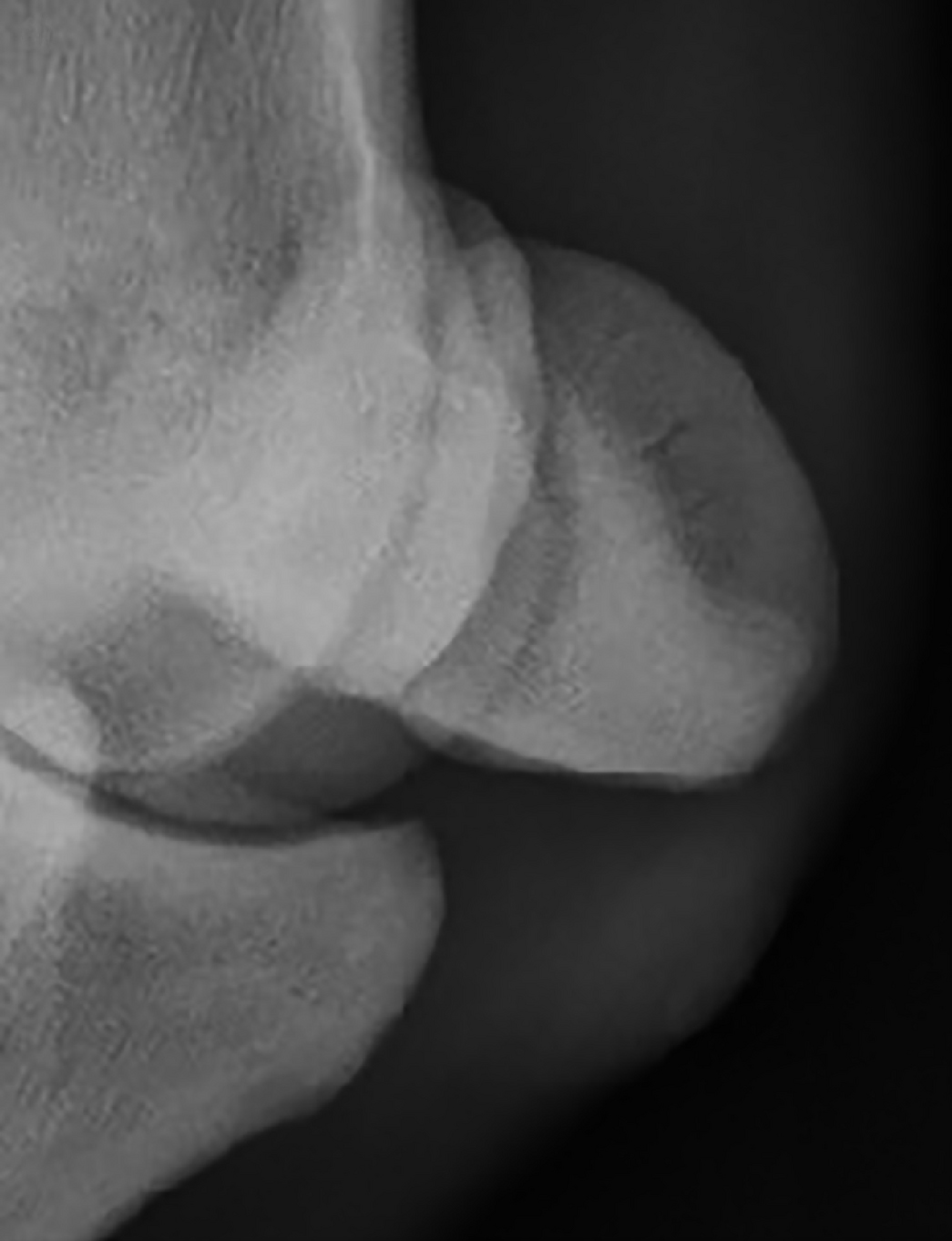 Horse Times Egypt: Equestrian Magazine :News :SUSPENSORY LIGAMENT BRANCH INJURY RISK IN THOROUGHBREDS 